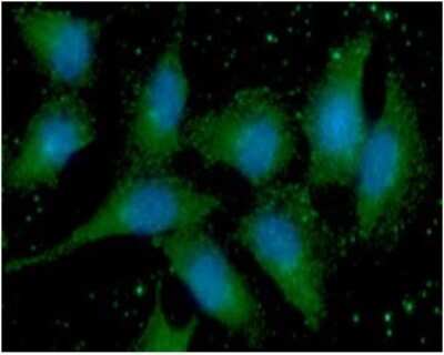 Immunocytochemistry/ Immunofluorescence: S100A11 Antibody (20D11) - BSA Free [NBP2-59472]