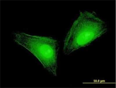 Immunocytochemistry/ Immunofluorescence: S100A11 Antibody (2F4) [H00006282-M01]