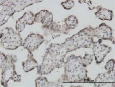 Immunohistochemistry-Paraffin: S100A11 Antibody (2F4) [H00006282-M01]