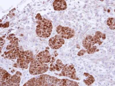 Immunohistochemistry-Paraffin: S100A11 Antibody [NBP1-32998]