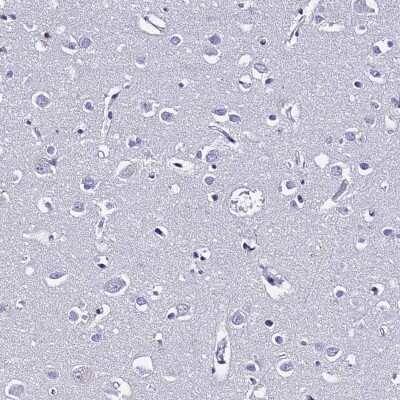 Immunohistochemistry-Paraffin: S100A11 Antibody [NBP2-13270]