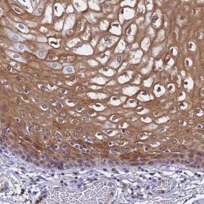 Immunohistochemistry-Paraffin: S100A11 Antibody [NBP2-13270]