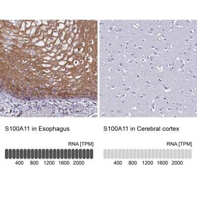 Immunohistochemistry-Paraffin: S100A11 Antibody [NBP2-13270]