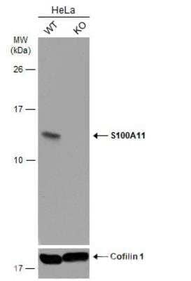 Western Blot: S100A11 Antibody [NBP1-32998]