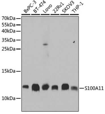 Western Blot: S100A11 AntibodyBSA Free [NBP3-03232]