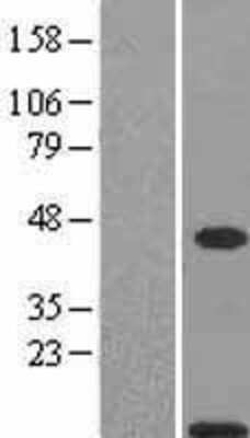 Western Blot: S100A11 Overexpression Lysate [NBL1-15649]