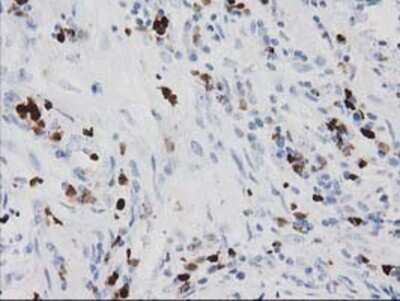 Immunohistochemistry-Paraffin: EN-RAGE/S100A12 Antibody (OTI1D1) [NBP2-03681]