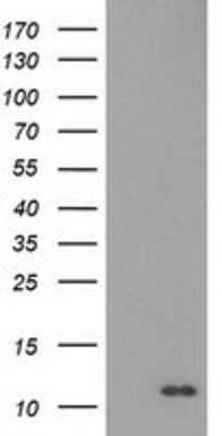 Western Blot: EN-RAGE/S100A12 Antibody (OTI1D1) [NBP2-03681]