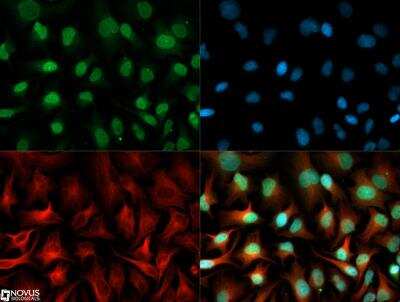 Immunocytochemistry/ Immunofluorescence: EN-RAGE/S100A12 Antibody [NB110-90136]