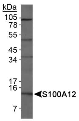 Western Blot: EN-RAGE/S100A12 Antibody [NB110-90136]