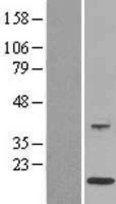 Western Blot: EN-RAGE/S100A12 Overexpression Lysate [NBL1-15650]