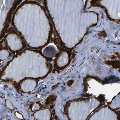 Immunohistochemistry-Paraffin: S100A13 Antibody [NBP1-86039]