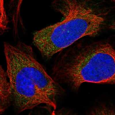 Immunocytochemistry/ Immunofluorescence: S100A16 Antibody [NBP1-92361]