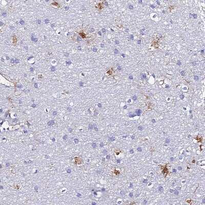 Immunohistochemistry-Paraffin: S100A16 Antibody [NBP1-92361]