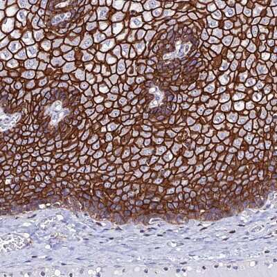 Immunohistochemistry-Paraffin: S100A16 Antibody [NBP1-92361]