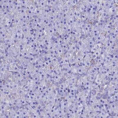 Immunohistochemistry-Paraffin: S100A16 Antibody [NBP1-92361]