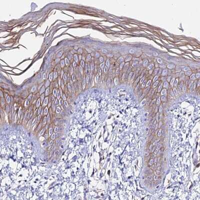 Immunohistochemistry-Paraffin: S100A16 Antibody [NBP1-92361]