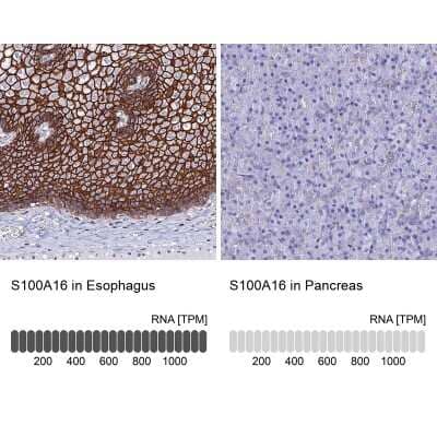 Immunohistochemistry-Paraffin: S100A16 Antibody [NBP1-92361]