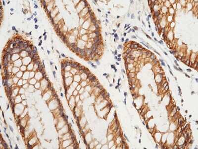 Immunohistochemistry-Paraffin: S100A16 Antibody [NBP2-99717]