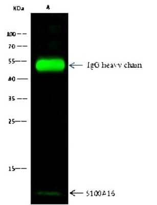 Immunoprecipitation: S100A16 Antibody [NBP2-99717]