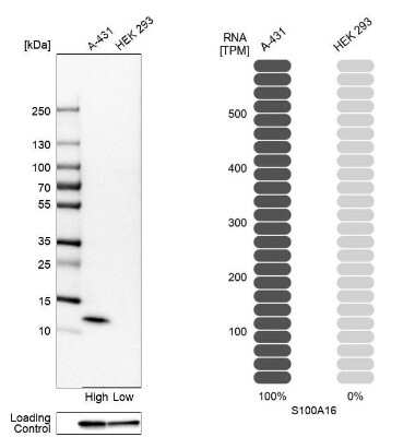 Western Blot: S100A16 Antibody [NBP1-92361]