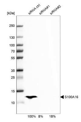 Western Blot: S100A16 Antibody [NBP1-92361]