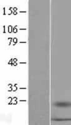 Western Blot: S100A16 Overexpression Lysate [NBL1-15653]