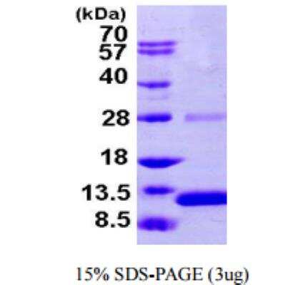 SDS-PAGE: Recombinant Human S100A2 His Protein [NBP1-51023]