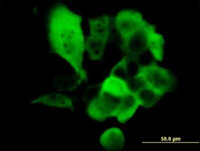 Immunocytochemistry/ Immunofluorescence: S100A2 Antibody (3H8) [H00006273-M03]