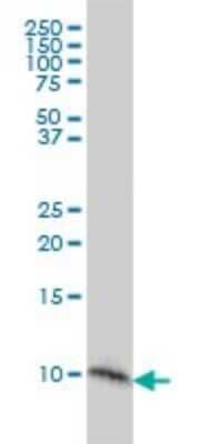 Western Blot: S100A2 Antibody (3H8) [H00006273-M03]