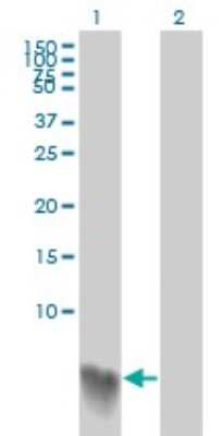 Western Blot: S100A2 Antibody (3H8) [H00006273-M03]