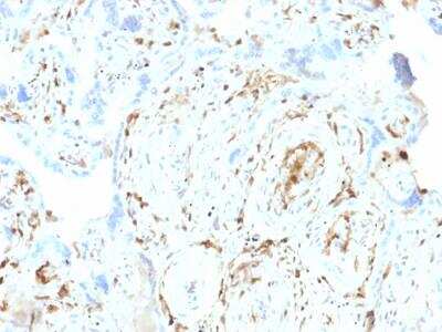 Immunohistochemistry-Paraffin: S100A2 Antibody (CPTC-S100A2-2) - Azide and BSA Free [NBP2-79899]