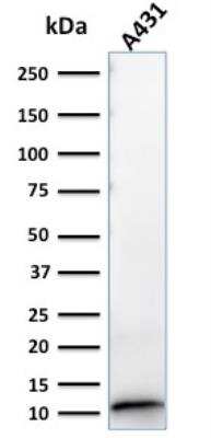 Western Blot: S100A2 Antibody (CPTC-S100A2-2)Azide and BSA Free [NBP2-79899]