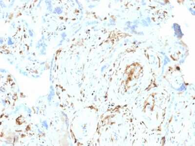 Immunohistochemistry-Paraffin: S100A2 Antibody (CPTC-S100A2-2) [NBP2-79764]