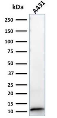 Western Blot: S100A2 Antibody (CPTC-S100A2-2) [NBP2-79764]