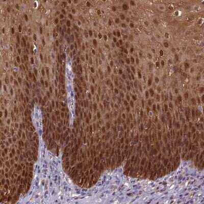 Immunohistochemistry-Paraffin: S100A2 Antibody [NBP2-38959]
