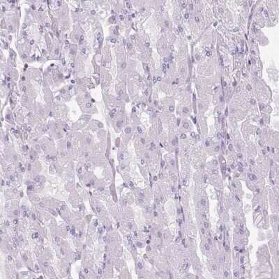 Immunohistochemistry-Paraffin: S100A2 Antibody [NBP2-38959]