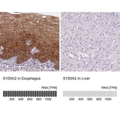 Immunohistochemistry-Paraffin: S100A2 Antibody [NBP2-38959]