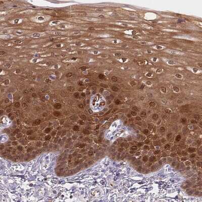 Immunohistochemistry-Paraffin: S100A2 Antibody [NBP2-38959]