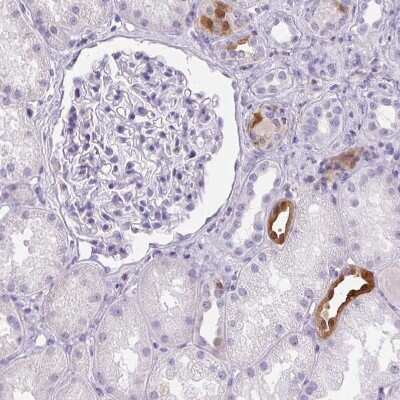 Immunohistochemistry-Paraffin: S100A2 Antibody [NBP2-38959]