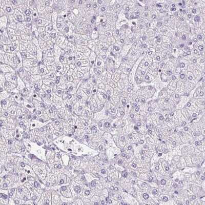 Immunohistochemistry-Paraffin: S100A2 Antibody [NBP2-38959]