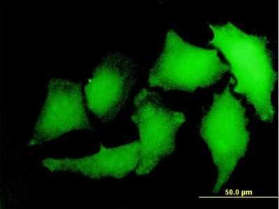 Immunocytochemistry/ Immunofluorescence: S100A2 Antibody (M2) [H00006273-M06]