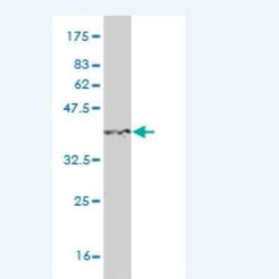 Western Blot: S100A3 Antibody (1D4) [H00006274-M01]