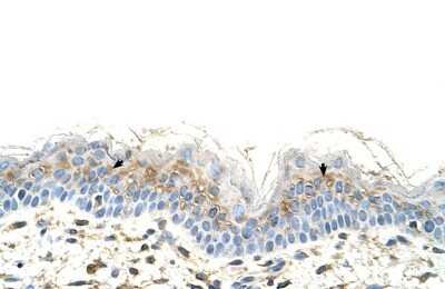 Immunohistochemistry-Paraffin: S100A3 Antibody [NBP1-54679]