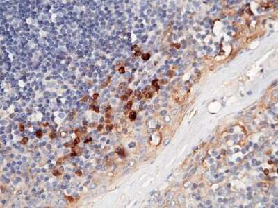 Immunohistochemistry-Paraffin: S100A3 Antibody [NBP2-99716]