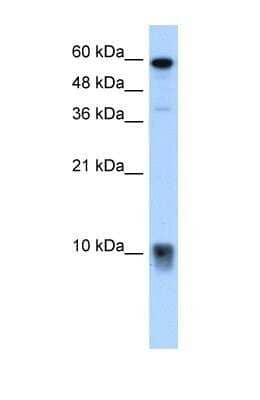 Western Blot: S100A3 Antibody [NBP1-54679]