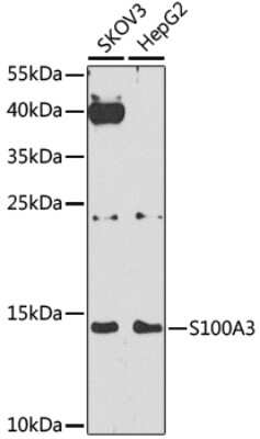 Western Blot: S100A3 AntibodyBSA Free [NBP2-94876]