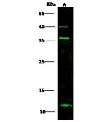 Western Blot: S100A3 Antibody [NBP2-98279]