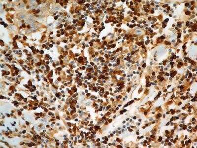 Immunohistochemistry: S100A4 Antibody (1C4) - Azide and BSA Free [NBP2-80936]