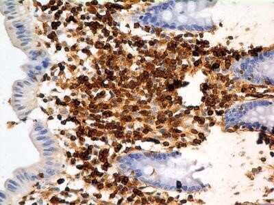 Immunohistochemistry: S100A4 Antibody (1C4) - Azide and BSA Free [NBP2-80936]